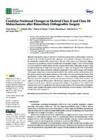 Condylar Positional Changes in Skeletal Class II and Class III Malocclusions after Bimaxillary Orthognathic Surgery
