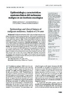 Epidemiology and clinical features of malignant melanoma. Analysis of 274 cases 